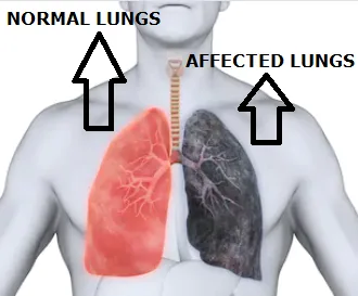 Air pollution control